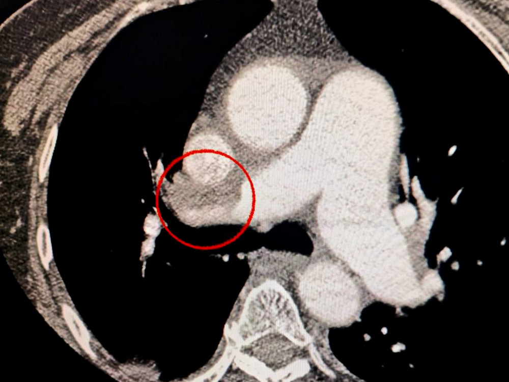 7364 image for slide