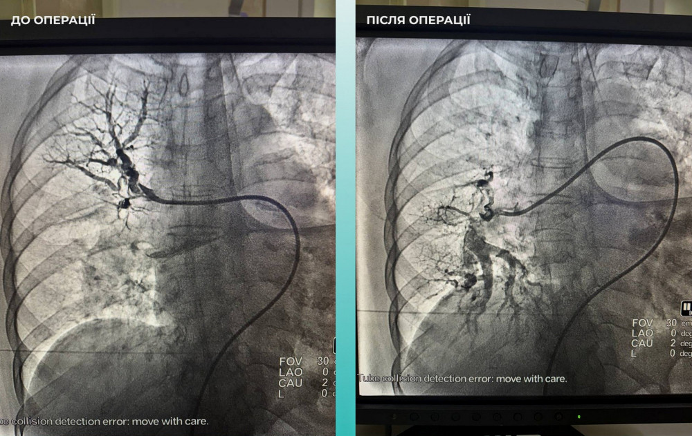 7365 image for slide