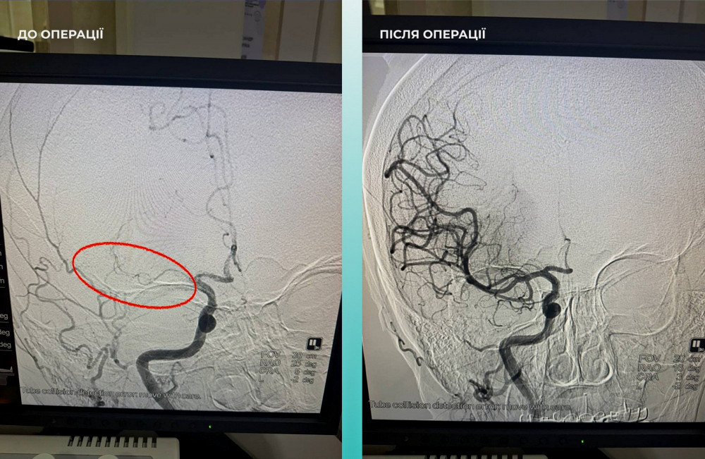 7367 image for slide